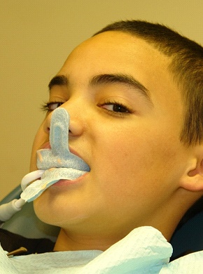 A child receiving fluoride therapy.