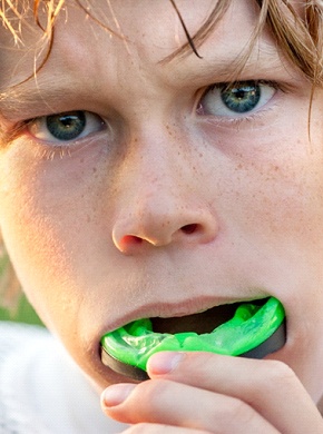 A young child placing a sportsguard into their mouth.