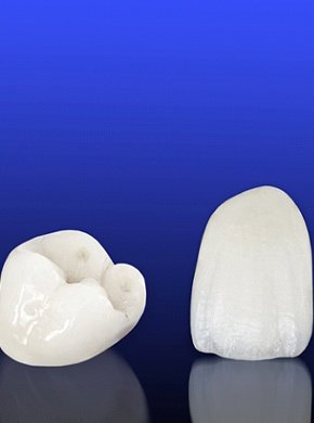 Dental crowns