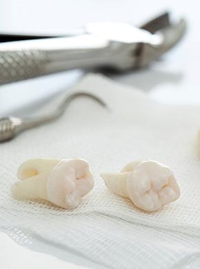 Series of extracted teeth resting next to dental instrument