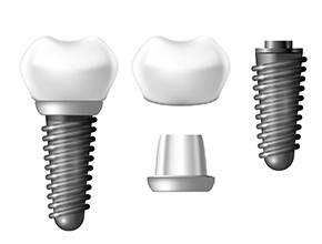 Different parts of a dental implant in Lisle, IL