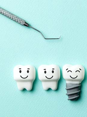 Illustration of dental implant in Manchester