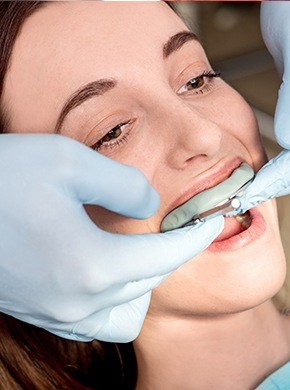 Patient fluoride varnish treatment