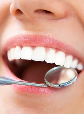 Closeup of healthy smile