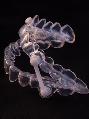 Oral appliance for sleep apnea on black background