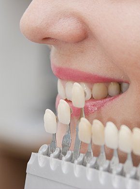 Woman's smile compared with tooth color chart