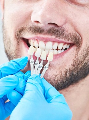 man being fitted for veneers