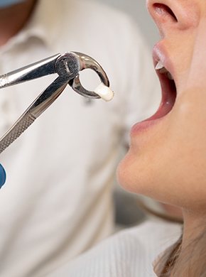 Dentist in Manchester performing wisdom tooth extraction