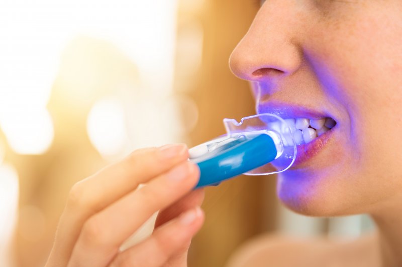 A mouth undergoing teeth whitening via a laser